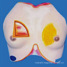 Female Breast Medical Anatomy Model for Demonstration (R150103)